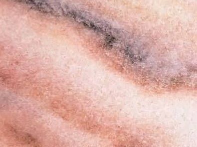 Solker Kristallmarmor