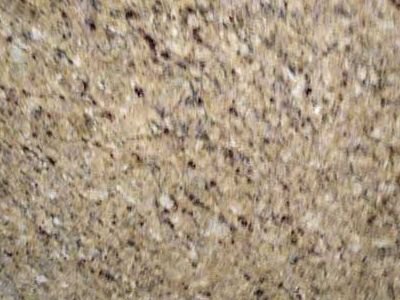 New Venishian Gold